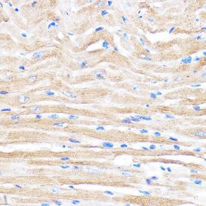 Immunohistochemistry analysis of paraffin-embedded mouse heart using Anti-ZMPSTE24 Antibody (A305482) at a dilution of 1:100 (40x lens). Perform microwave antigen retrieval with 10 mM PBS buffer pH 7.2 before commencing with IHC staining protocol.