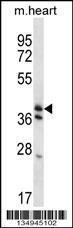 Anti-KLF2 Rabbit Polyclonal Antibody (AP (Alkaline Phosphatase))