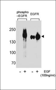 Anti-EGFR Rabbit Polyclonal Antibody (HRP (Horseradish Peroxidase))