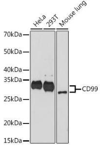 Western blot analysis of extracts of various cell lines, using Anti-CD99 Antibody [ARC1752] (A309328) at 1:1,000 dilution