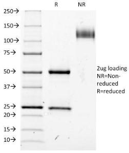 SDS-PAGE analysis of Anti-IL2 Receptor alpha Antibody [IL2RA/423] under non-reduced and reduced conditions; showing intact IgG and intact heavy and light chains, respectively. SDS-PAGE analysis confirms the integrity and purity of the Antibody