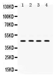 Anti-NR2F2 Rabbit Polyclonal Antibody