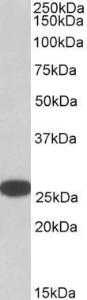 Anti-RANBP1 antibody