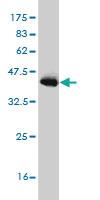 Anti-PIAS3 Mouse Monoclonal Antibody [clone: 4F12]