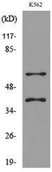 Anti-IL2RG antibody