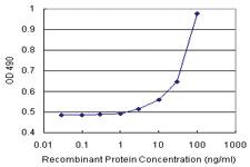 Anti-GLMN Polyclonal Antibody Pair