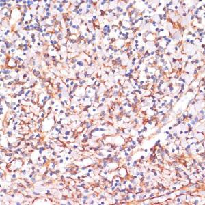 Immunohistochemistry analysis of paraffin-embedded human tonsil using Anti-IKK alpha Antibody (A11508) at a dilution of 1:100 (40x lens) Perform microwave antigen retrieval with 10 mM PBS buffer pH 72 before commencing with IHC staining protocol