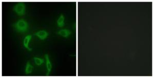 Immunofluorescence analysis of HepG2 cells using Anti-IARS2 Antibody. The right hand panel represents a negative control, where the Antibody was pre-incubated with the immunising peptide