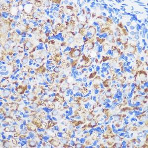 Immunohistochemistry analysis of paraffin-embedded rat ovary using Anti-ZMPSTE24 Antibody (A305482) at a dilution of 1:100 (40x lens). Perform microwave antigen retrieval with 10 mM PBS buffer pH 7.2 before commencing with IHC staining protocol.