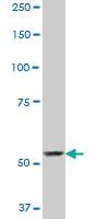 Anti-SP110 Mouse Monoclonal Antibody [clone: 8C8]