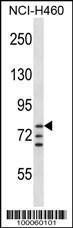 Anti-ARNT Rabbit Polyclonal Antibody