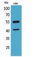 Anti-IL2RG antibody