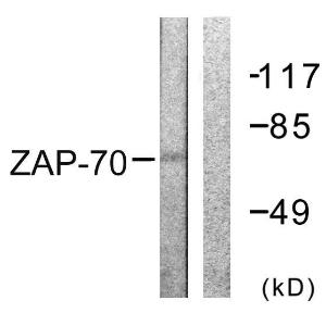 Western blot analysis of lysates from 293 cells, treated with PMA 125ng/ml 30' using Anti-ZAP-70 Antibody. The right hand lane represents a negative control, where the antibody is blocked by the immunising peptide.