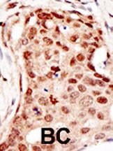 Anti-CBLC Rabbit Polyclonal Antibody