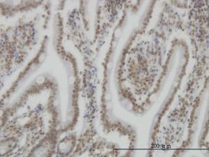 Anti-SP110 Mouse Monoclonal Antibody [clone: 8C8]