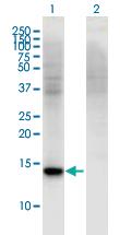 Anti-RBP7 Mouse Monoclonal Antibody [clone: 4F4]