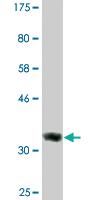 Anti-DICER1 Mouse Monoclonal Antibody [clone: 2F12]