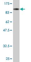 Anti-ZNF263 Mouse Monoclonal Antibody [clone: 3C9]