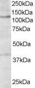 Anti-HPS3 Antibody (A84038) (1 µg/ml) staining of A431 lysate (35 µg protein in RIPA buffer). Primary incubation was 1 hour. Detected by chemiluminescence