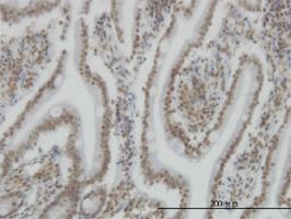 Anti-SP110 Mouse Monoclonal Antibody [clone: 8C8]