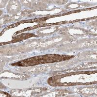 Anti-UFL1 Rabbit Polyclonal Antibody