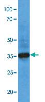 Anti-AKR1C1 Mouse Monoclonal Antibody [clone: AT6D10]