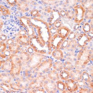 Immunohistochemistry analysis of paraffin-embedded mouse kidney using Anti-IKK alpha Antibody (A11508) at a dilution of 1:100 (40x lens) Perform microwave antigen retrieval with 10 mM PBS buffer pH 72 before commencing with IHC staining protocol