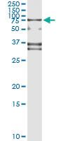 Anti-SP110 Mouse Monoclonal Antibody [clone: 8C8]