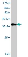 Anti-ZPR1 Mouse Monoclonal Antibody [clone: 6F7]