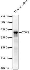 Anti-CDX2 Rabbit Monoclonal Antibody [clone: ARC3070]