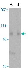 Anti-SLITRK1 Rabbit Polyclonal Antibody