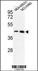 Anti-KLF4 Rabbit Polyclonal Antibody (Biotin)