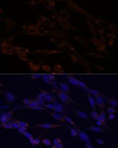 Immunofluorescence analysis of NIH/3T3 cells using Anti-IKK alpha Antibody (A11508) at a dilution of 1:100 DAPI was used to stain the cell nuclei (blue)