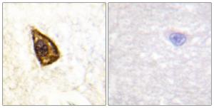 Immunohistochemical analysis of paraffin-embedded human brain tissue using Anti-Trk B Antibody. The right hand panel represents a negative control, where the Antibody was pre-incubated with the immunising peptide