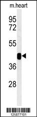 Anti-B3GNT7 Rabbit Polyclonal Antibody