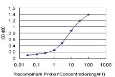 Anti-SP110 Mouse Monoclonal Antibody [clone: 8C8]