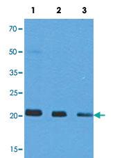 Anti-NRAS Mouse Monoclonal Antibody [clone: AT2G9]