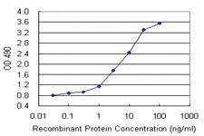 Anti-KCNIP3 Polyclonal Antibody Pair