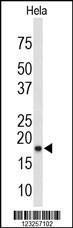 Anti-COX4I1 Rabbit Polyclonal Antibody (APC (Allophycocyanin))