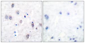 Immunohistochemical analysis of paraffin-embedded human brain using Anti-Amyloid beta A4 Antibody. The right hand panel represents a negative control, where the antibody was pre-incubated with the immunising peptide