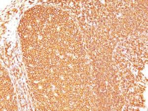 Immunohistochemical analysis of formalin-fixed, paraffin-embedded human tonsil using Anti-CD45 Antibody [Bra55]