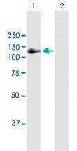 Anti-AMOTL1 Mouse Polyclonal Antibody