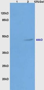 Anti-GLA Rabbit Polyclonal Antibody