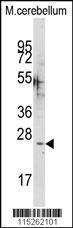 Anti-CABP1 Rabbit polyclonal antibody unconjugated