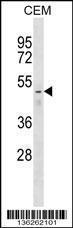 Anti-FNTB Rabbit Polyclonal Antibody (FITC (Fluorescein Isothiocyanate))