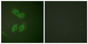 Immunofluorescence analysis of HeLa cells using Anti-Amyloid beta A4 Antibody. The right hand panel represents a negative control, where the antibody was pre-incubated with the immunising peptide