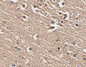 Anti-SLITRK1 Rabbit Polyclonal Antibody