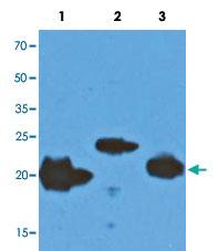 Anti-NRAS Mouse Monoclonal Antibody [clone: AT2G9]