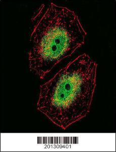 Anti-BCL6 Mouse Monoclonal Antibody [clone: 305CT16.3.3]