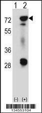 Anti-EWSR1 Rabbit Polyclonal Antibody (PE (Phycoerythrin))